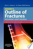 Adams's outline of fractures, including joint injuries.